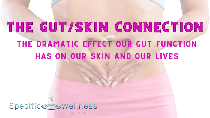 Gut health